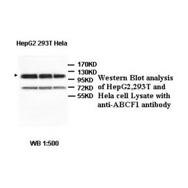 ACBD7 Antibody