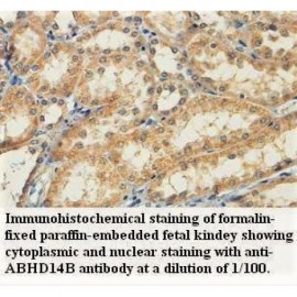 ABHD14B Antibody