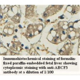 ABCF3 Antibody