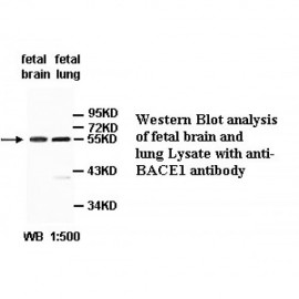 BACE1 Antibody