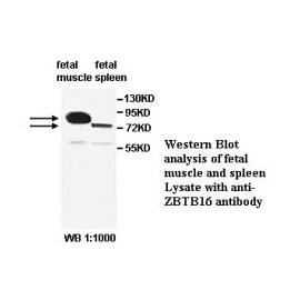 ZBTB6 Antibody