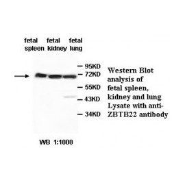 ZBTB6 Antibody