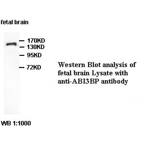 ABI3BP Antibody