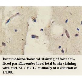 ZCCHC12 Antibody