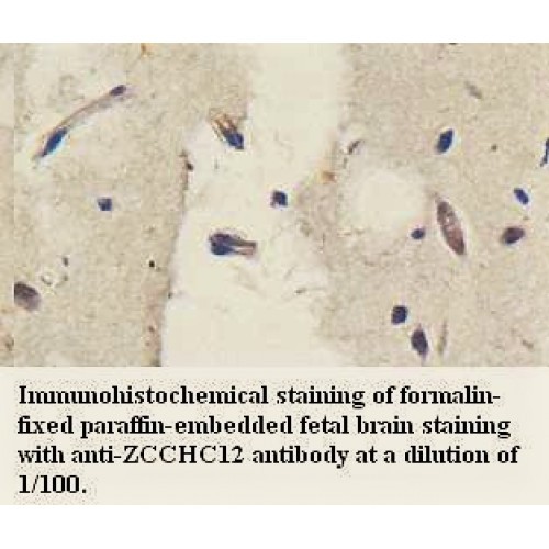 ZCCHC12 Antibody