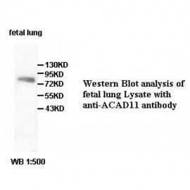 ZBTB6 Antibody