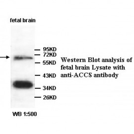 ACCS Antibody