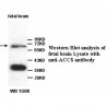 ACCS Antibody