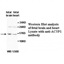ACYP1 Antibody