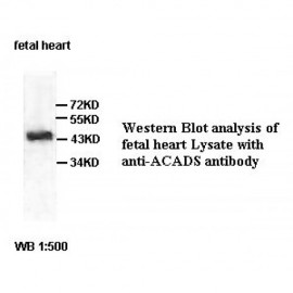 ACADS Antibody