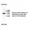 ACADS Antibody