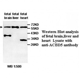ACBD5 Antibody