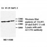 ACCN2 Antibody