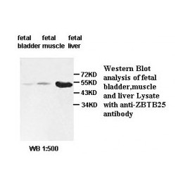 BCL2 Antibody