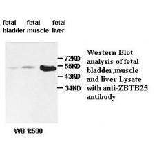 BCL2 Antibody
