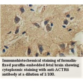 ACTR6 Antibody