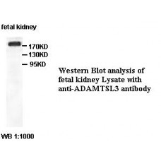 BCL2 Antibody
