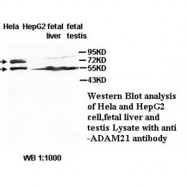 ADAM21 Antibody