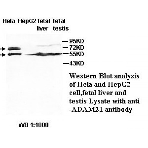 ADAM21 Antibody
