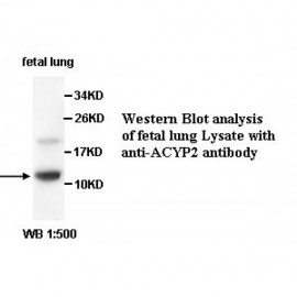 ACYP2 Antibody