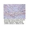 ADRBK2 Antibody