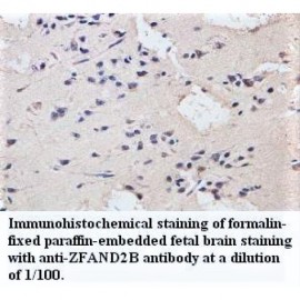 ZFAND2B Antibody