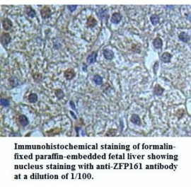 ZFP161 Antibody