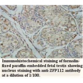 ZFP112 Antibody