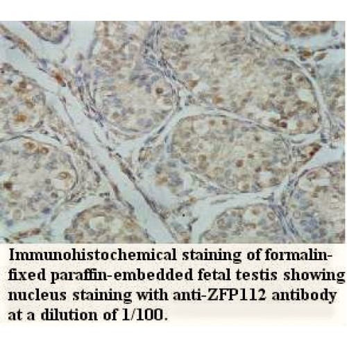 ZFP112 Antibody