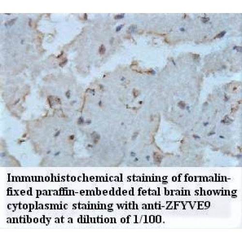 ZFYVE9 Antibody