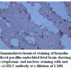 AGBL5 Antibody
