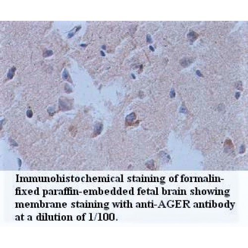 AGER Antibody