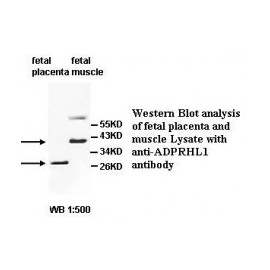 ADPRHL1 Antibody