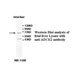 ADCK2 Antibody