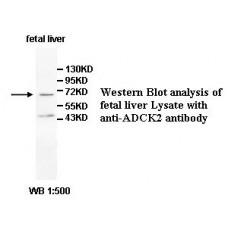 ADCK2 Antibody
