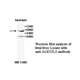 AGXT2L2 Antibody