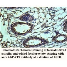 IL18 Antibody