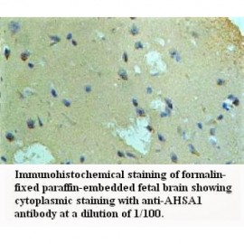 AHSA1 Antibody