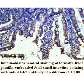 AGR2 Antibody