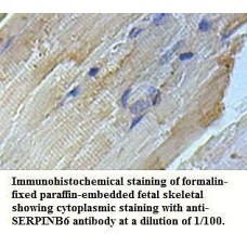 IL18 Antibody