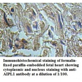 AIPL1 Antibody