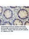 AIPL1 Antibody
