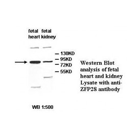 ZFP28 Antibody