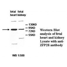 ZFP28 Antibody