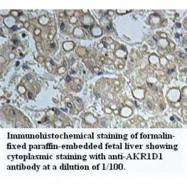 AKR1D1 Antibody