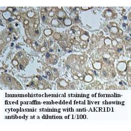AKR1D1 Antibody