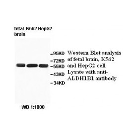 AGBL4 Antibody
