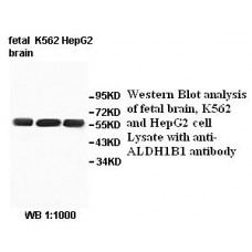 AGBL4 Antibody