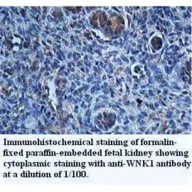 WNK1 Antibody