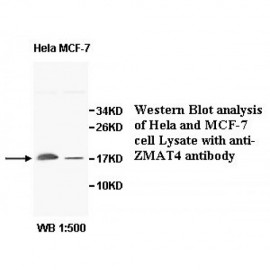 ZMAT4 Antibody